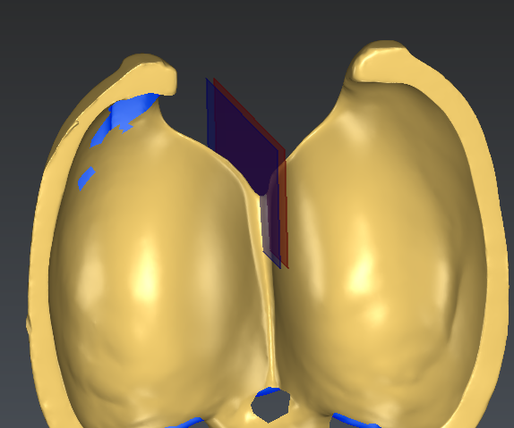 images/download/attachments/226230956/SymmetricPlane.PNG